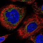 Immunofluorescent staining of human cell line A-431 shows localization to vesicles.
