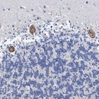 Immunohistochemical staining of human cerebellum shows moderate cytoplasmic positivity in Purkinje cells.