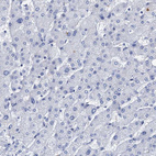 Immunohistochemical staining of human liver shows no positivity in hepatocytes as expected.