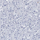 Immunohistochemical staining of human liver shows no positivity in hepatocytes as expected.