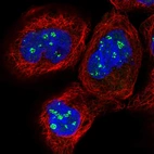 Immunofluorescent staining of human cell line A-431 shows localization to nucleoli fibrillar center.