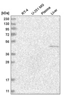 Anti-NR6A1 Antibody