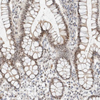 Immunohistochemical staining of human colon shows moderate to strong nuclear positivity in glandular cells.