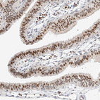 Immunohistochemical staining of human fallopian tube shows strong nuclear positivity in glandular cells.