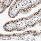 Immunohistochemical staining of human fallopian tube shows strong nuclear positivity in glandular cells.