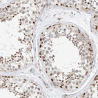Immunohistochemical staining of human testis shows moderate to strong nuclear positivity in cells in seminiferous ducts.