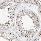 Immunohistochemical staining of human testis shows moderate to strong nuclear positivity in cells in seminiferous ducts.