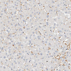 Immunohistochemical staining of human liver shows no positivity in hepatocytes as expected.
