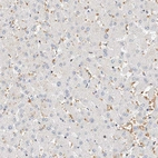 Immunohistochemical staining of human liver shows no positivity in hepatocytes as expected.