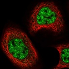 Immunofluorescent staining of human cell line A-431 shows localization to nucleoplasm.