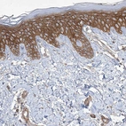 Immunohistochemical staining of human skin shows strong cytoplasmic-membranous positivity in squamous epithelial cells.