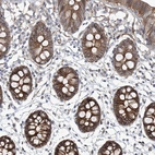 Immunohistochemical staining of human gastrointestinal shows strong cytoplasmic-membranous positivity in glandular cells.