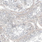 Immunohistochemical staining of human testis shows weak positivity in peritubular myoid cells.