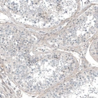 Immunohistochemical staining of human testis shows weak positivity in peritubular myoid cells.