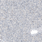 Immunohistochemical staining of human pancreas shows no positivity in exocrine glandular cells as expected.