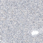 Immunohistochemical staining of human pancreas shows no positivity in exocrine glandular cells as expected.