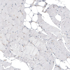 Immunohistochemical staining of human skeletal muscle shows no positivity in myocytes as expected.