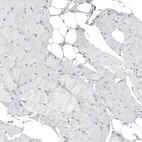 Immunohistochemical staining of human skeletal muscle shows no positivity in myocytes as expected.