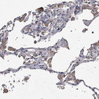 Anti-ABCG1 Antibody