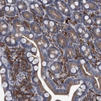 Immunohistochemical staining of human duodenum shows strong cytoplasmic positivity in macrophages.