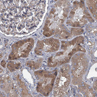 Anti-ABCG1 Antibody