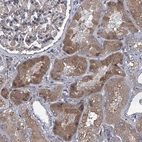 Immunohistochemical staining of human kidney shows moderate cytoplasmic positivity in cells in tubules.
