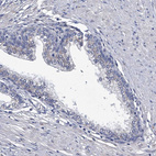 Anti-ABCG1 Antibody