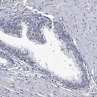 Immunohistochemical staining of human prostate shows very weak cytoplasmic positivity in glandular cells.