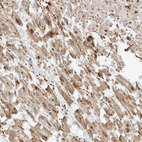 Anti-MTUS2 Antibody