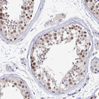 Immunohistochemical staining of human testis shows moderate nuclear positivity in cells in seminiferous ducts.