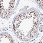 Immunohistochemical staining of human testis shows moderate nuclear positivity in cells in seminiferous ducts.