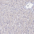 Immunohistochemical staining of human liver shows no positivity in hepatocytes as expected.