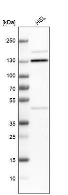 Western blot analysis in human cell line HEL.