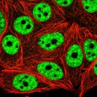 Immunofluorescent staining of human cell line MCF7 shows localization to nucleoplasm.