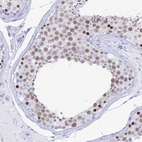 Immunohistochemical staining of human testis shows moderate to strong nuclear positivity in cells in seminiferous ducts.