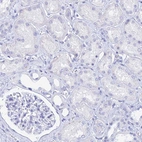 Immunohistochemical staining of human kidney shows no positivity in cells in tubules as expected.