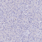 Immunohistochemical staining of human pancreas shows no positivity in exocrine glandular cells as expected.