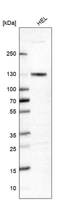 Western blot analysis in human cell line HEL.
