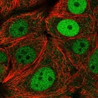 Immunofluorescent staining of human cell line MCF7 shows localization to nucleoplasm.