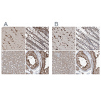 Anti-ERLEC1 Antibody