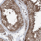 Immunohistochemical staining of human testis shows moderate granular cytoplasmic positivity in cells in seminiferous ducts.