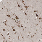 Immunohistochemical staining of human cerebral cortex shows strong granular cytoplasmic positivity in neurons.