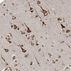 Immunohistochemical staining of human cerebral cortex shows strong granular cytoplasmic positivity in neurons.