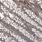Immunohistochemical staining of human colon shows moderate granular cytoplasmic positivity in glandular cells.