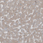 Immunohistochemical staining of human liver shows weak granular cytoplasmic positivity in hepatocytes.