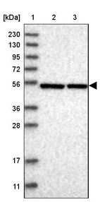 Lane 1: Marker [kDa] 230, 130, 95, 72, 56, 36, 28, 17, 11_br/_Lane 2: Human cell line RT-4_br/_Lane 3: Human cell line U-251MG sp