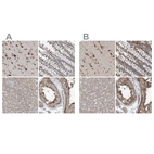 Anti-ERLEC1 Antibody