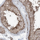 Immunohistochemical staining of human testis shows moderate granular cytoplasmic positivity in cells in seminiferous ducts.