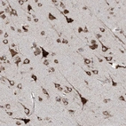Immunohistochemical staining of human cerebral cortex shows strong granular cytoplasmic positivity in neurons.
