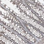 Immunohistochemical staining of human colon shows weak granular cytoplasmic positivity in glandular cells.
